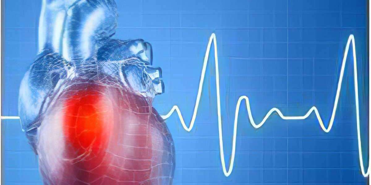 Atrial Fibrillation Devices Market Global Analysis, Opportunities, Growth Forecast to 2031